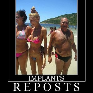 implants2