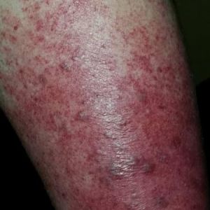 10253957 10203575029559271 7496996518481699861 n