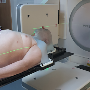 Radiotherapy 23 July 2023 Frying Tonight